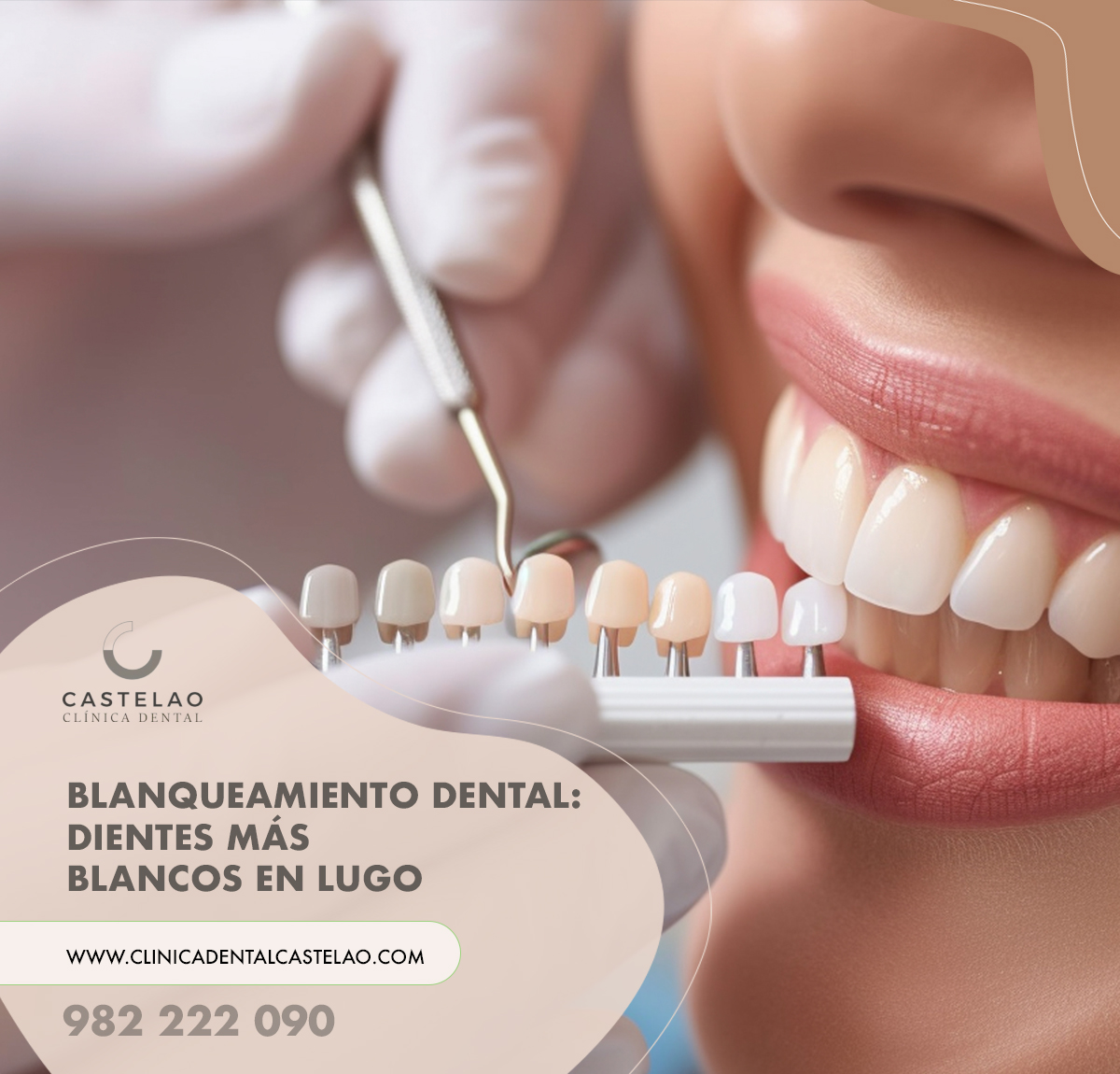 Blanqueamiento dental en Lugo